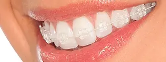 Aparelho Odontológico